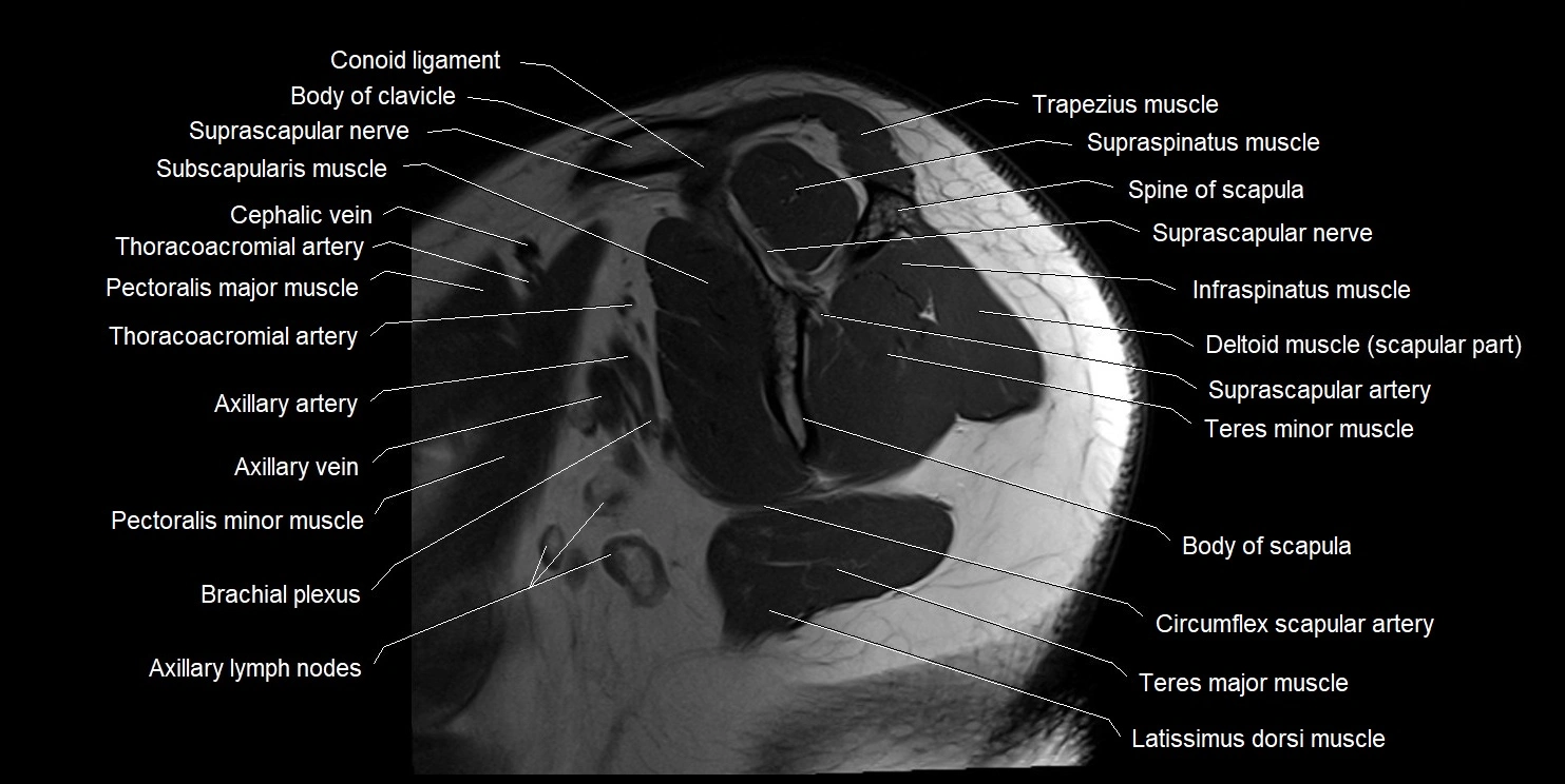 mri shoulder sagittal cross sectional anatomy image 2.webp